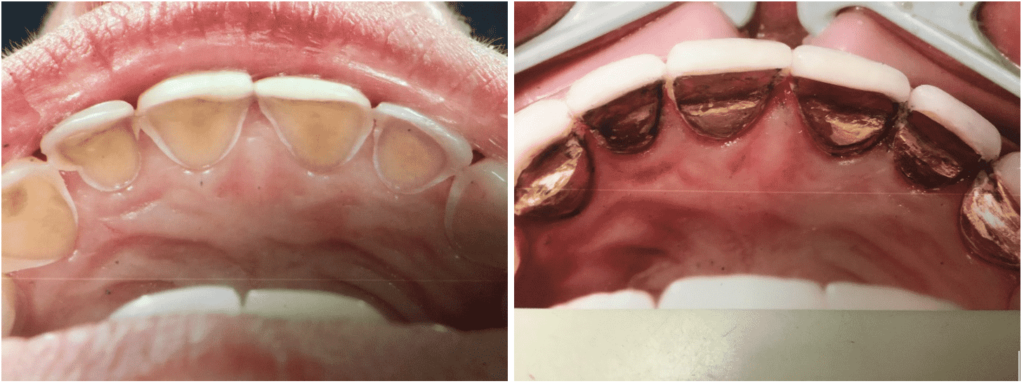 img-221-min - Encino dentist Dr. Isaac Comfortes, D.D.S. questions