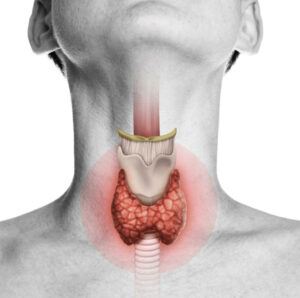 - Encino dentist Dr. Isaac Comfortes, D.D.S. Thyroid